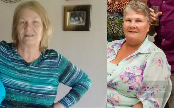 Weight Loss testimonial Norma before and after weight loss photo semelia