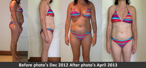 Weight Loss testimonial Alison slimming nut before and after photo